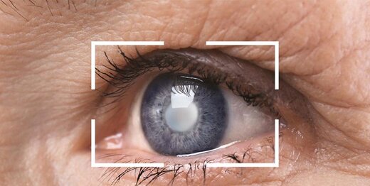 eyes